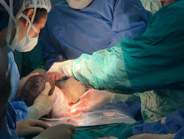 Sağlık Bakanlığı planlı Sezaryeni yasakladı